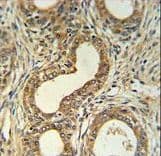 Polyclonal Rabbit anti-Human ROBO4 Antibody (aa236-264, IHC, WB)