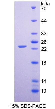 Human CLMP / ACAM Protein (Recombinant His-T7)
