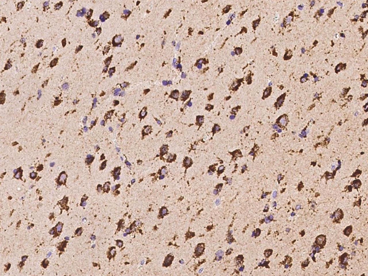 PPT1 / CLN1 Antibody