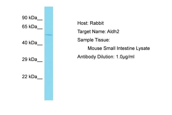 ALDH2 Antibody (aa401-450)