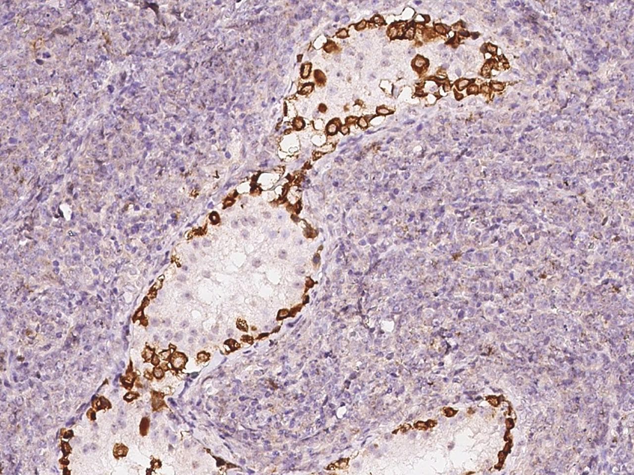 Polyclonal Rabbit anti-Human MAP7D2 Antibody (IHC)