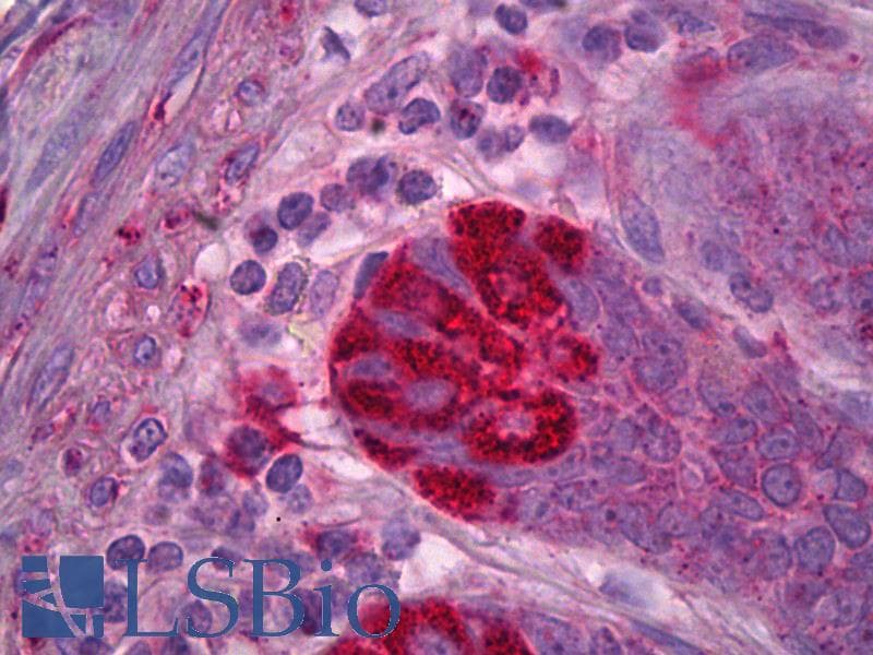 IHC-plus™ MAPK8 / JNK1 Antibody (clone 1A2)