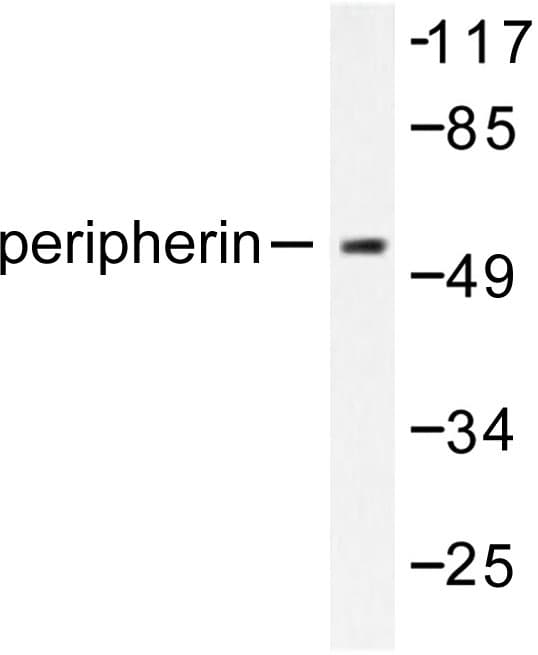 Polyclonal Rabbit anti-Human Peripherin Antibody (Ser454, IHC, WB)