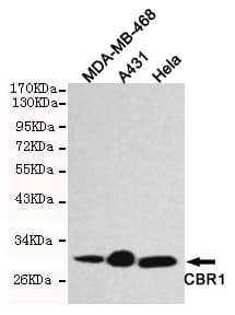 CBR / CBR1 Antibody