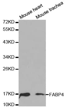 Polyclonal Rabbit anti-Human FABP4 / AP2 Antibody (IHC, IF, WB)