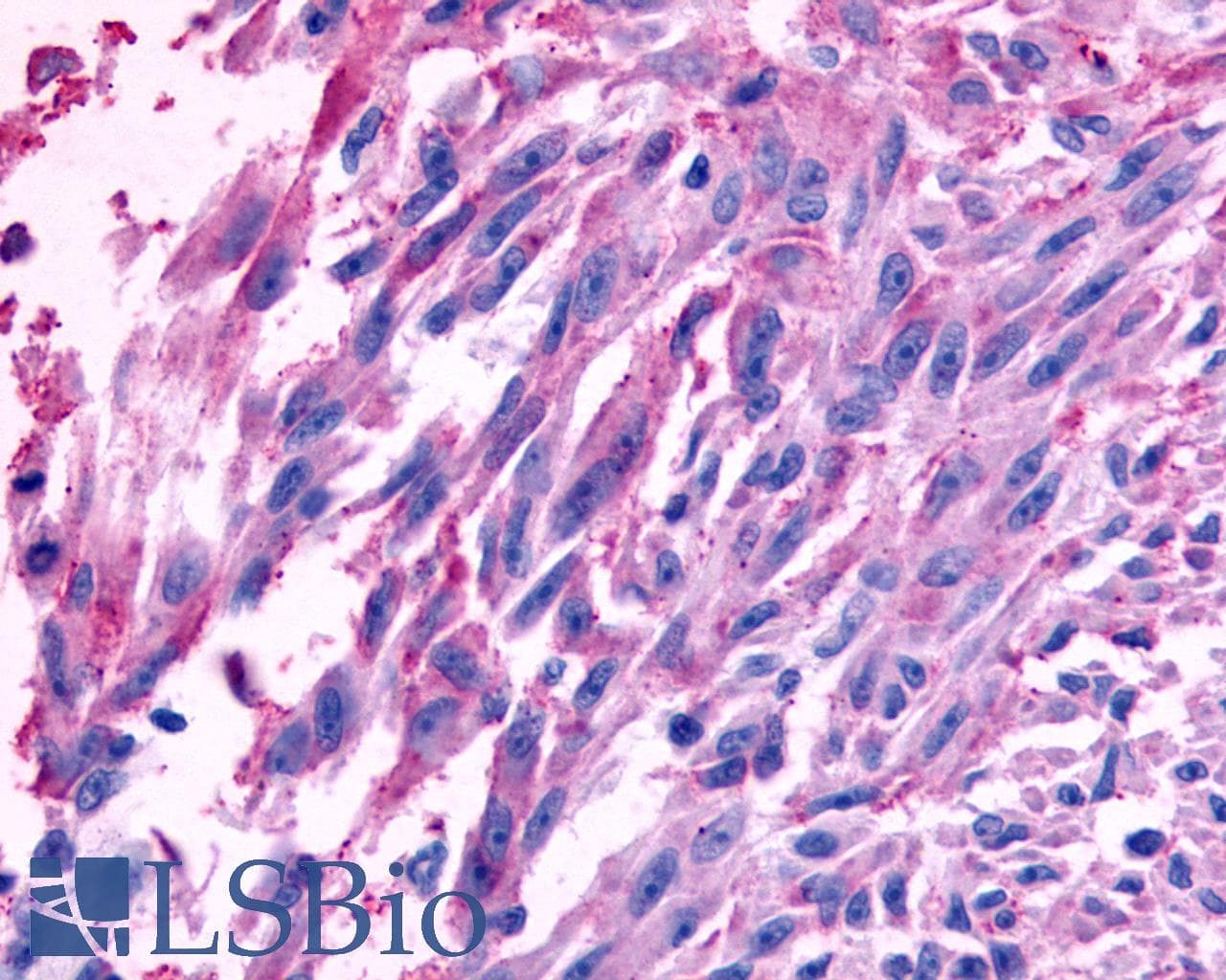IHC-plus™ FZD10 / Frizzled 10 Antibody (N-Terminus)