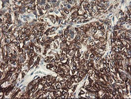 SLA2 / SLAP2 Antibody (clone OTI3A7)