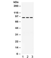 Polyclonal Rabbit anti-Human PRLR / Prolactin Receptor Antibody (WB)