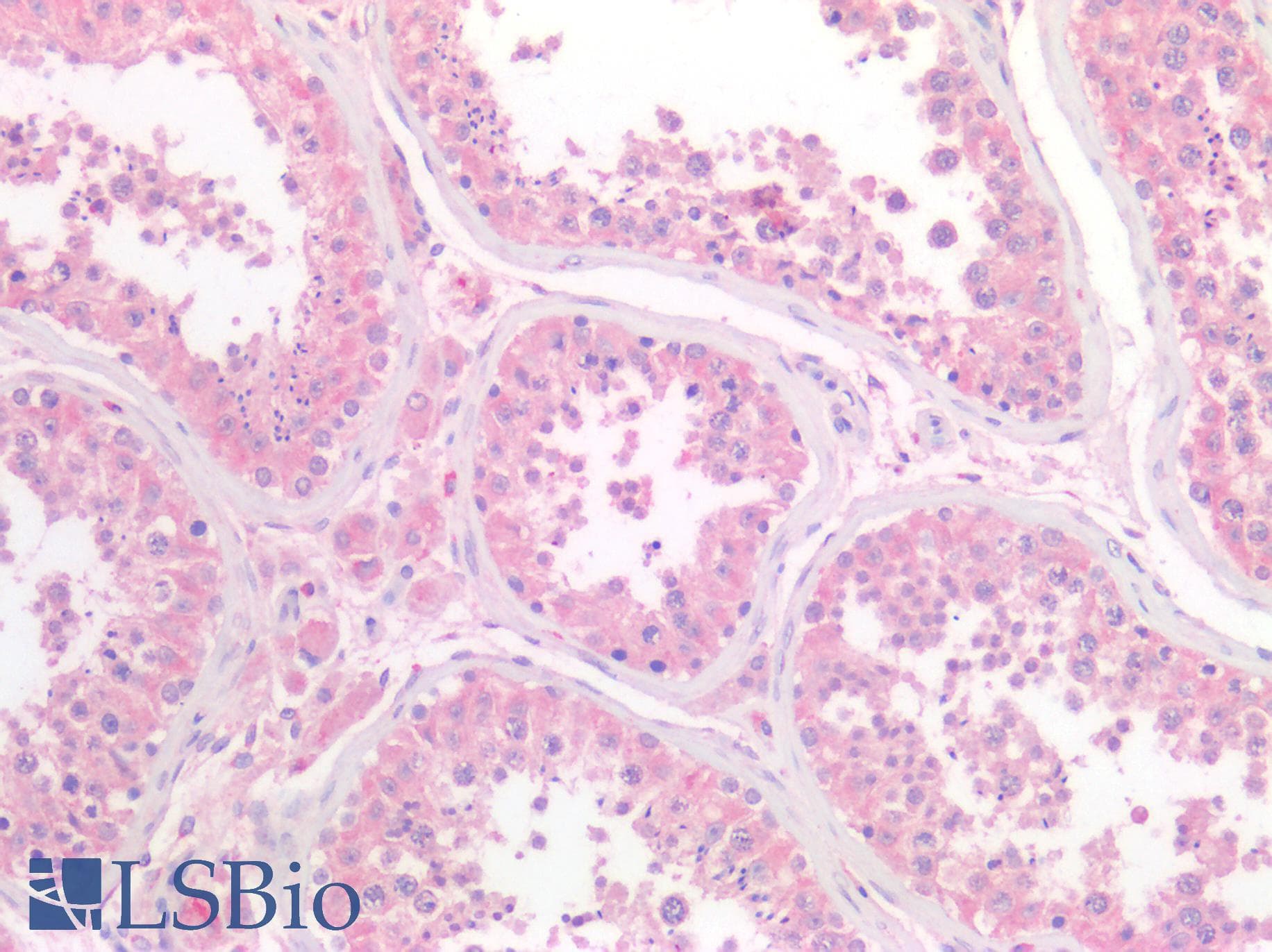 IHC-plus™ Polyclonal Rabbit anti-Human Osteonectin / SPARC Antibody (IHC)