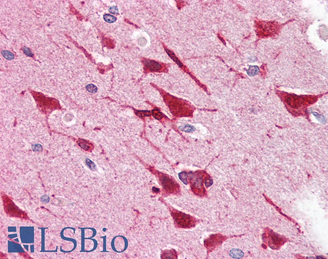 IHC-plus™ Monoclonal Mouse anti-Rat GRB2 Antibody (IHC, WB)