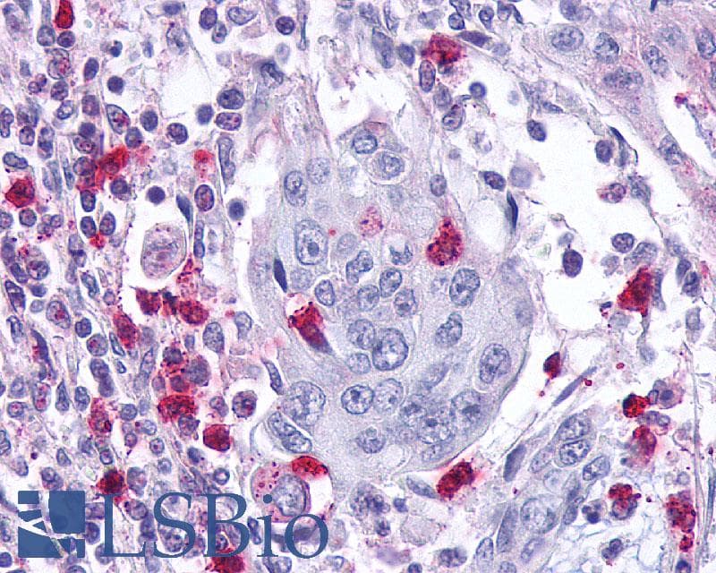 PathPlus™ Leukotriene B4 Receptor / BLT1 Antibody (Cytoplasmic Domain)