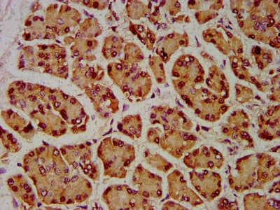 Polyclonal Rabbit anti-Human SIAH2 Antibody (IHC, IF)