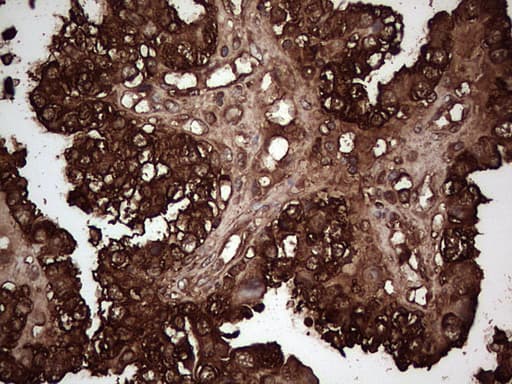 PKM2 Antibody (clone 1G10)