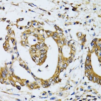 RPN1 / Ribophorin I Antibody