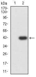 ALDH1A1 / ALDH1 Antibody (clone 2G1G4)