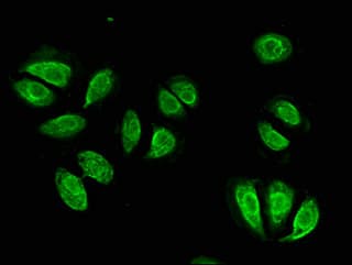 ITGB4 / Integrin Beta 4 Antibody