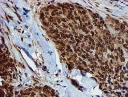 GSTT2 Antibody (clone OTI3B6)