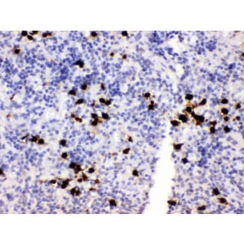 Polyclonal Rabbit anti-Mouse S100A8 / MRP8 Antibody (aa2-89, IHC, WB)