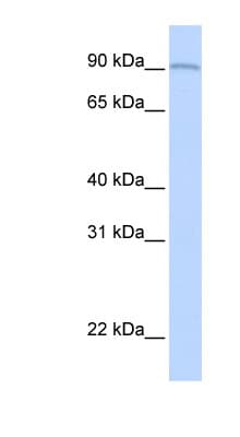 AOC2 / SSAO Antibody (aa684-733)