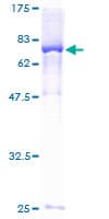 Human DUS2 / DUS2L Protein (Recombinant GST)