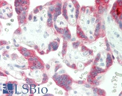 PSG / PSG5 Antibody (C-Terminus)