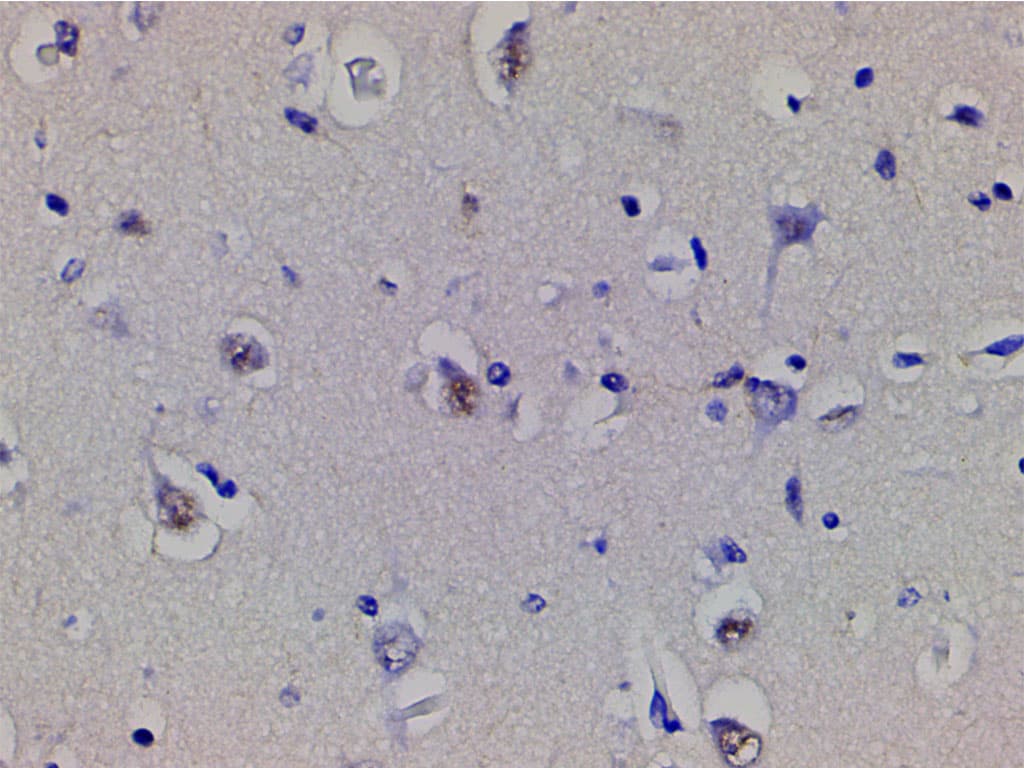 CFL1 / Cofilin Antibody (phospho-Ser3)