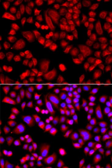 p21-ARC / ARPC3 Antibody