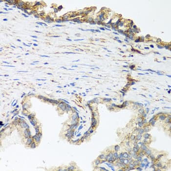 Polyclonal Rabbit anti-Human WNT5A Antibody (IHC, WB)