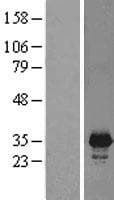 Human PNMT Protein (Over-Expression Lysate Myc-DDK (Flag))
