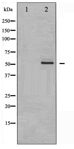 EPOR / EPO Receptor Antibody (phospho-Tyr368)