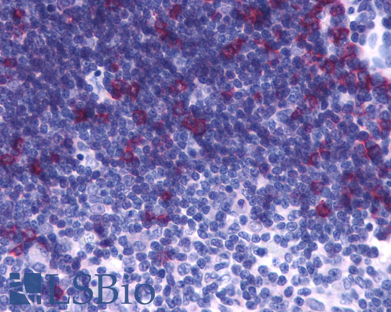 IHC-plus™ GPR44 / CRTH2 Antibody (C-Terminus)