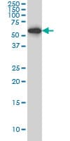 IHC-plus™ HDAC1 Antibody (clone 1D6)