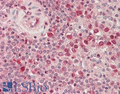RIOK2 Antibody (aa107-156)
