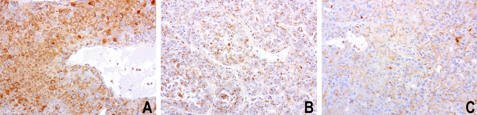 SDCBP / Syntenin Antibody (clone UMAB69)