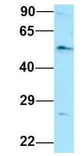 EIF2B3 Antibody (aa217-266)
