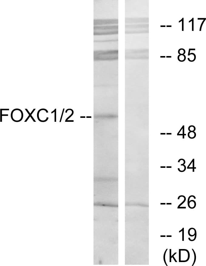 FOXC1+2 Antibody (aa151-200)