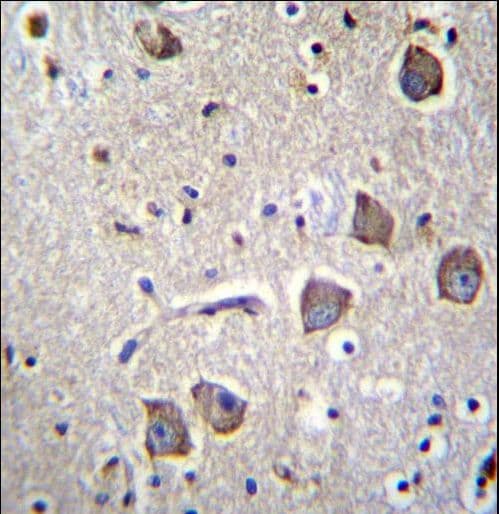 NRN1L Antibody (aa40-69)