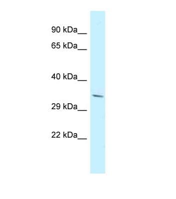 PDLIM7 / Enigma Antibody (aa147-196)