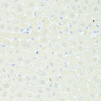 Polyclonal Rabbit anti-Human TRIM15 Antibody (IHC, WB)