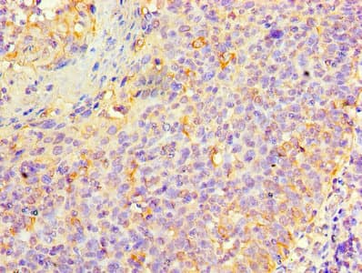 KRT6A / CK6A / Cytokeratin 6A Antibody (aa2-564)