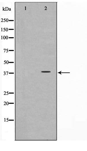 SYP / Synaptophysin Antibody