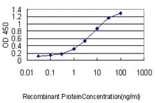 Monoclonal Mouse anti-Human ARA55 / HIC-5 Antibody (clone 4B2-D8, WB)