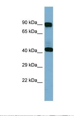 IVD Antibody (aa62-111)