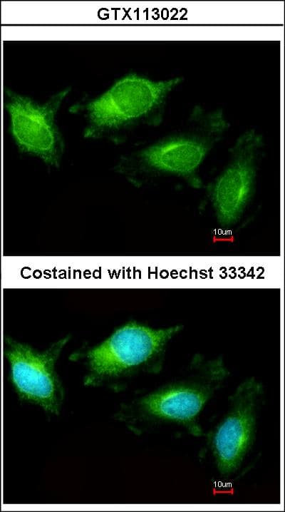 IHC-plus™ TLR3 Antibody
