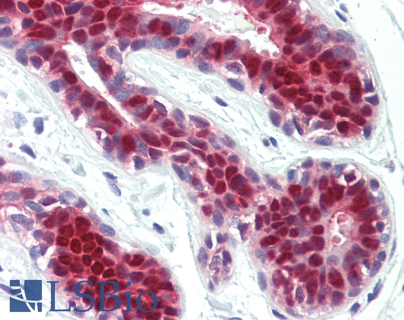 IHC-plus™ STAT5A Antibody (clone 4E7)