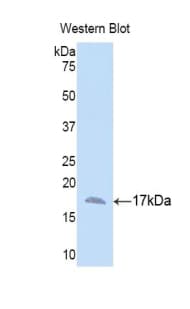 ANXA3 / Annexin A3 Antibody (aa26-160, Cy3)