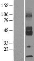 SLC2A6 / GLUT6 Protein (Over-Expression Lysate Myc-DDK (Flag))