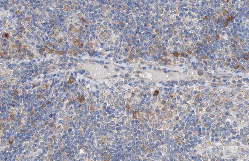 GRB4 / NCK2 Antibody