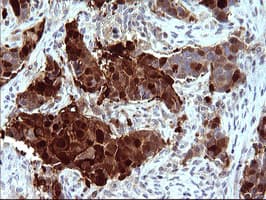 SERPINB3 Antibody (clone OTI1G1)