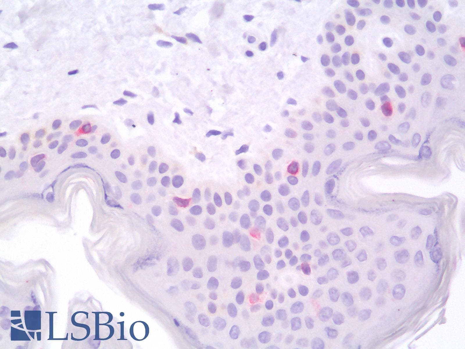 PathPlus™ CD207 / Langerin Antibody (clone 12D6)